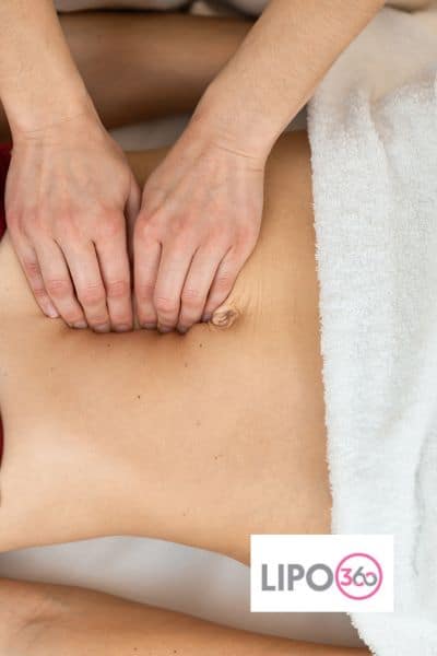 diastasis recti treatment Aldridge
