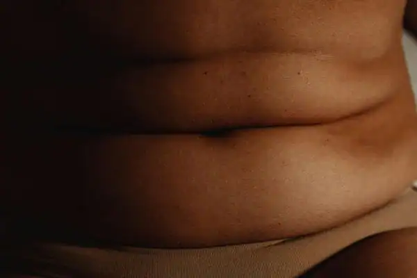 The Hidden Connection: How Stress Shapes Your Fitness and Body Composition 3 image of what stress can do on the stomach area and how Lipo 360 Aldridge can help to change your body shape.